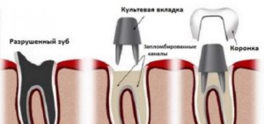 Можно ли восстановить зуб если остались корни